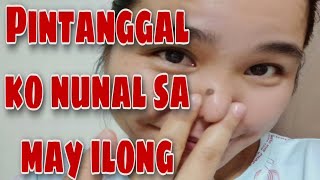 PINATANGGAL KO NUNAL SA MAY ILONG [upl. by Nnaeinahpets]