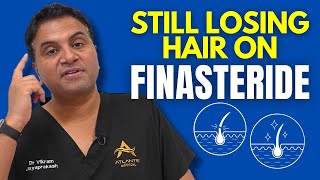 Still Losing Hair Even When On Finasteride [upl. by Biggs]