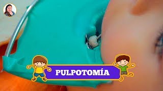 PULPOTOMÍA para NIÑOS 👦🏻  ODONTOPEDIATRÍA 😀  CLÍNICA DENTAL Hada 🧚🏻 [upl. by Otreblif736]