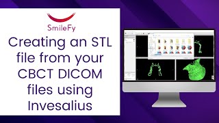 Tutorial Creating an STL file from your CBCT DICOM files using Invesalius [upl. by Onra]