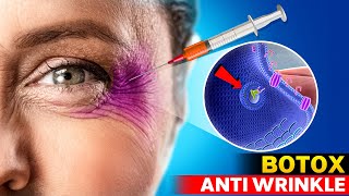 How Botox Works  How Does Botulinum Toxin Work Botox lasts how long [upl. by Helbonnas365]