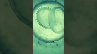 Journey of IVF Embryo Development ivf ivfjourney ivfsuccess [upl. by Aiderfla]