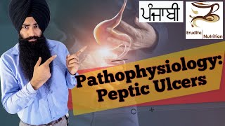 What is Peptic Ulcer Types causes treatment 23 Punjabi [upl. by Aneelak283]