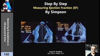 Step By Step EF Measuring by Simpson [upl. by Olympium]