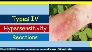 Lecture 7 Type IV Hypersensitivity Reaction [upl. by Kazmirci]