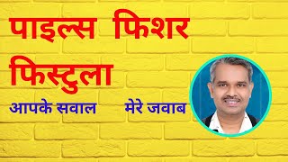 Piles Problem treatment  Fissure treatment  Piles surgery queries in hindi [upl. by Dunlavy797]