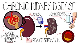 Understanding Chronic Kidney Disease CKD [upl. by Itaws781]