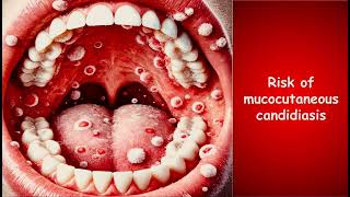 Oral thrush Mucocutaneous candidiasis risk factors HIV immunology microbiology [upl. by Dona]