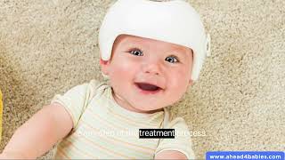 Positional Plagiocephaly Helmet Flat Head Infant Treatment [upl. by Eelirol987]