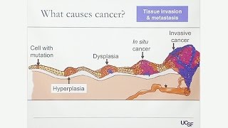 Overview of Gynecologic Cancers [upl. by Normac]