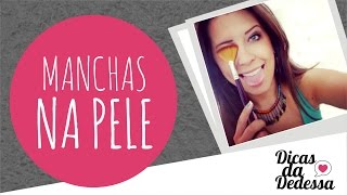 Manchas na Pele  DICAS DA DEDESSA [upl. by Bean]