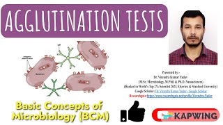 Agglutination tests I Immunology I Hemagglutination tests I Hemagglutination Inhibition tests I [upl. by Reider]