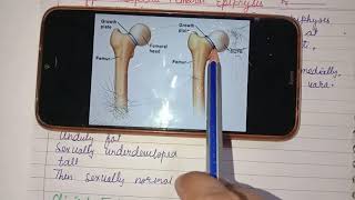 Slipped Capital Femoral Epiphysis [upl. by Nyledaj]