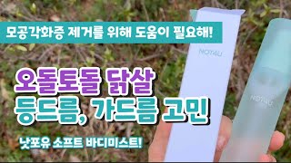 닭살피부 없애는법 닭살피부 바디 미스트 낫포유 소프트 바디 미스트 모공각화증과 여드름의 차이를 알고 도움받자 팔뚝이나 종아리에 분사하고 닭살 벗어나기 프로젝트 여름 바프준비 [upl. by Solnit]