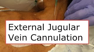 External Jugular Vein Cannulation [upl. by Odlamur46]