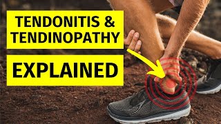 Tendinopathy amp Tendonitis Explained [upl. by Laryssa]