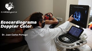 Ecocardiograma Doppler Color [upl. by Suki44]