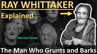 RAY WHITTAKER Explained The Man Who Grunts and Barks [upl. by Sedaiuqlem]