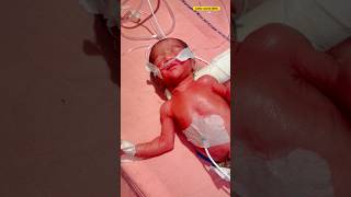 Premature newborn baby weight 900grmsnewbornbabybabyreviewprematurebaby [upl. by Zetra43]