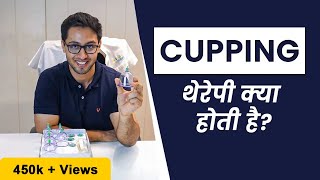 What Is Cupping Therapy  Benefits of Cupping Therapy  Do You Need Cupping Therapy [upl. by Ecirpak]