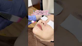 Peeling doang kok 🤭 saffaclinic klinikkecantikan melanopeel peelingwajah treatmentflek [upl. by Kerrison]