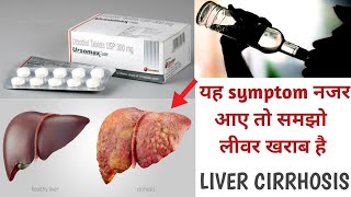 Ursomax 300 TabletUrsodeoxycholic Acidयह symptom नजर आए तो समझो लीवर खराब हैUsesHow To Take [upl. by Verna]