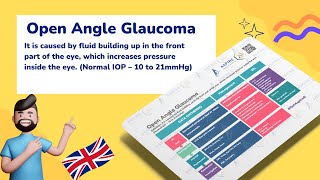 Open Angle Glaucoma  Ophthalmology [upl. by Elbertina]