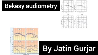 BEKESY audiometry  differential diagnosis of cp and rcp by bekesy audiometry by Jatin gurjar [upl. by Moritz490]