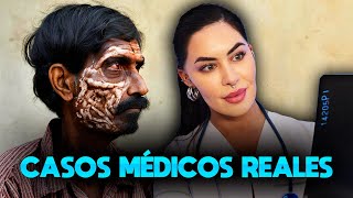 CASOS MÉDICOS REALES [upl. by Cati819]