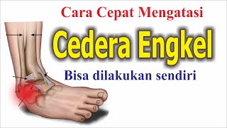 Cara Mengatasi Keseleo Engkel  Ankle Sprain  Dengan Pijat Sendiri [upl. by Kcirrej]