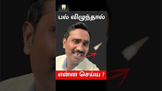 பல் விழுந்தால் என்ன செய்வது  What to do when a tooth is knocked out Dr Dinesh Kowsky [upl. by Winifred283]