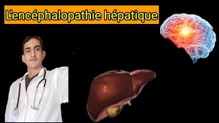 lencéphalopathie hépatique [upl. by Anahsahs]