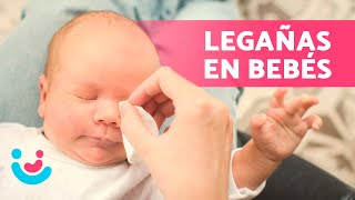 ¿Cómo QUITAR LEGAÑAS en BEBÉS 👁️👶🏾 ¿Qué las Causa ¿Es Normal [upl. by Dopp]