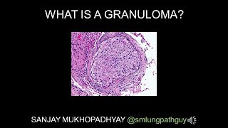 What is a granuloma [upl. by Ramo77]