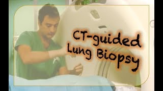 CTguided Lung Biopsy procedure and technique [upl. by Files596]