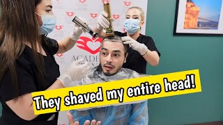 My hair transplant journey Philippines  Steven Bansil [upl. by Hardin]