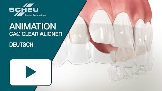 CA® CLEAR ALIGNER Animation deutsch [upl. by Kerstin]