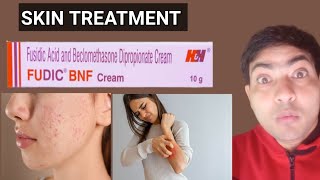 fudic bnf cream use in hindi [upl. by Lorollas]