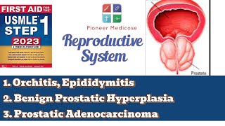 USMLE step 1 Epidimitis orchitis and BPH from First Aid Reproductive system pathUrduHindi [upl. by Watanabe]