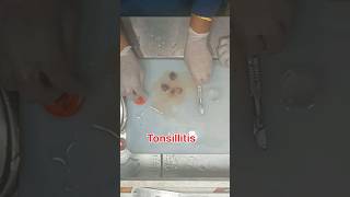 Tonsillitis tissue for histopathology processing [upl. by Sandy]