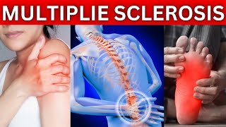 12 Early Warning Signs of Multiple Sclerosis You Shouldnt Ignore MS [upl. by Retsim280]