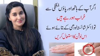 Best Solution for dry skin of hand and feet by Dr Shaista Lodhi  Ladies Talk [upl. by Alexandro]