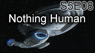 Star Trek Voyager Ruminations S5E08 Nothing Human [upl. by Waiter]