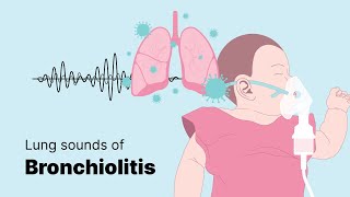 Sounds of Bronchiolitis  Lung Sounds [upl. by Dlareme]