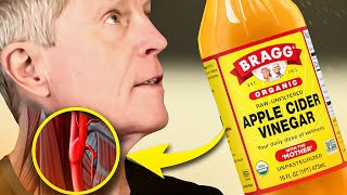 The 1 Thing you SHOULD Know About Apple Cider Vinegar [upl. by Novert]