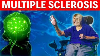 Multiple Sclerosis Traveling Tips  Full Guide [upl. by Cleland]