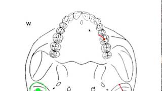 DYNAMIC OCCLUSION  Working vs Nonworking Movement amp Occlusal Grid [upl. by Oeak]