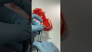 🔥 Extracting Hot or Infected Teeth  OnlineExodontiacom  dentist dentistry dentaltips [upl. by Darees]