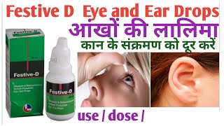 Festive Dee Optic EyeEar Drops Uses in Hindi  Festive Dee Optic Eye Drops  Eye Drops shorts [upl. by Landing]