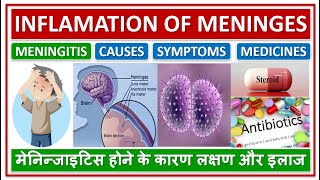 MENINGITIS INFLAMATION OF MENINGES OF BRAIN TREATMENT मेनिन्जाइटिस होने के कारण लक्षण और इलाज [upl. by Denoting263]